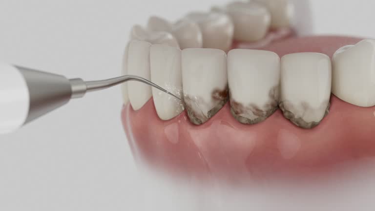 Trusted Emergency Dentist service in West Canton, NC - Dentist Open Now